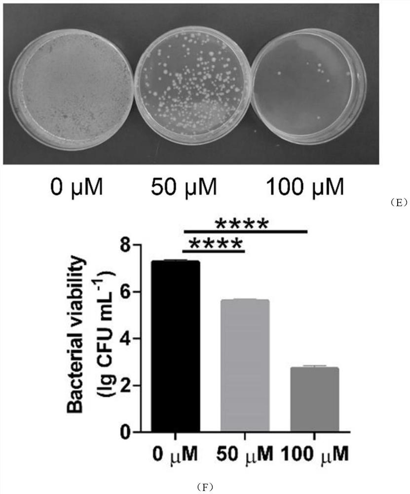 Application of nanogold in preparation of medicine for treating shigella infectious enteritis and medicine preparation of nanogold