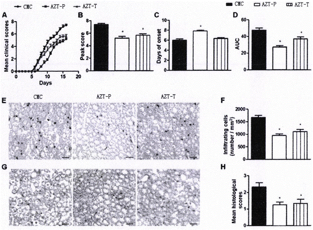 Application of zidovudine used for preparation of medicine for treating autoimmune neuritis