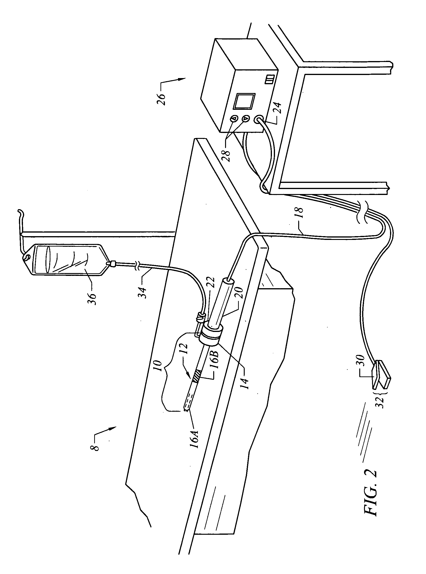 Electrosurgical method and system for treating foot ulcer