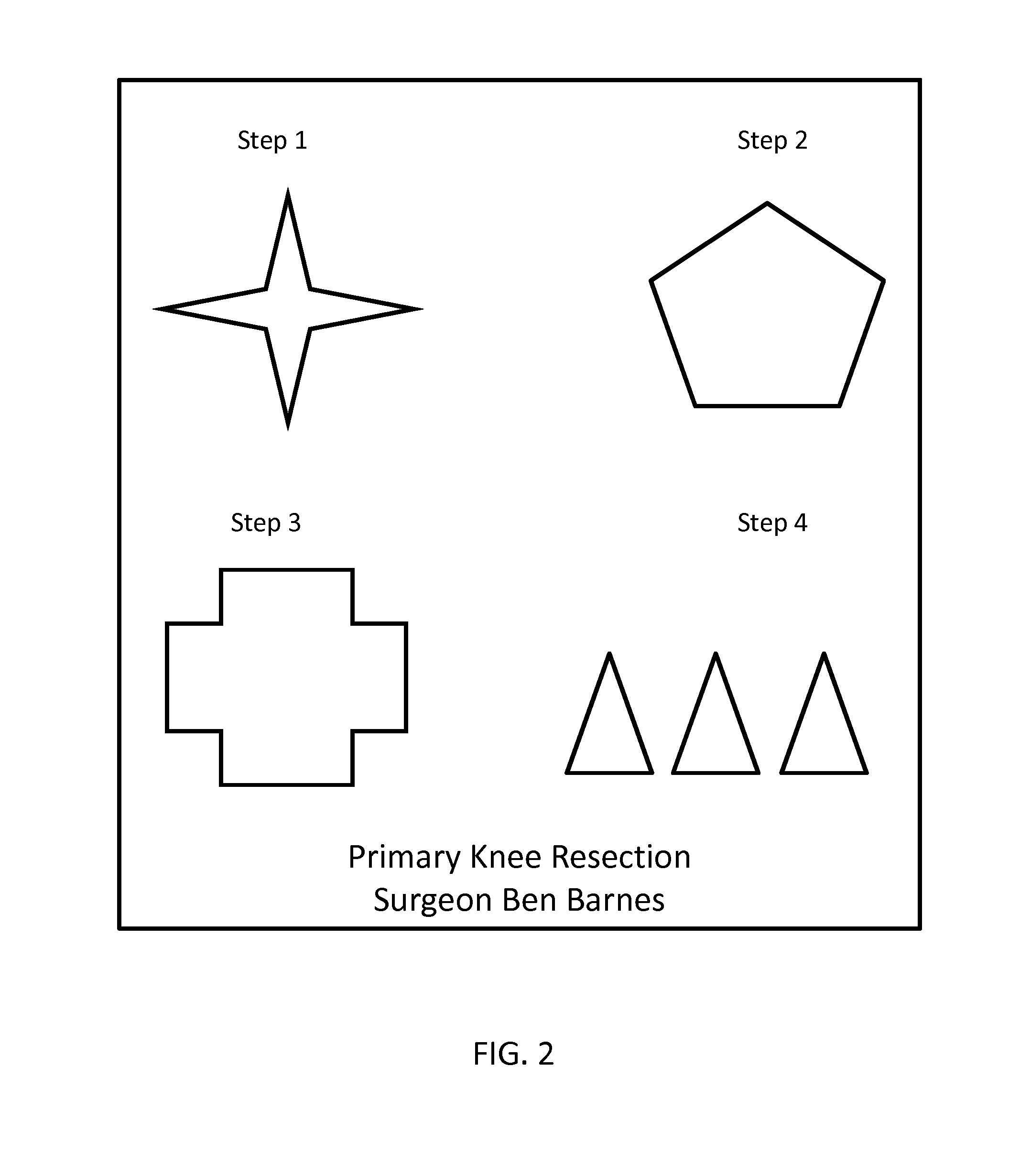 Customizable Surgical Template