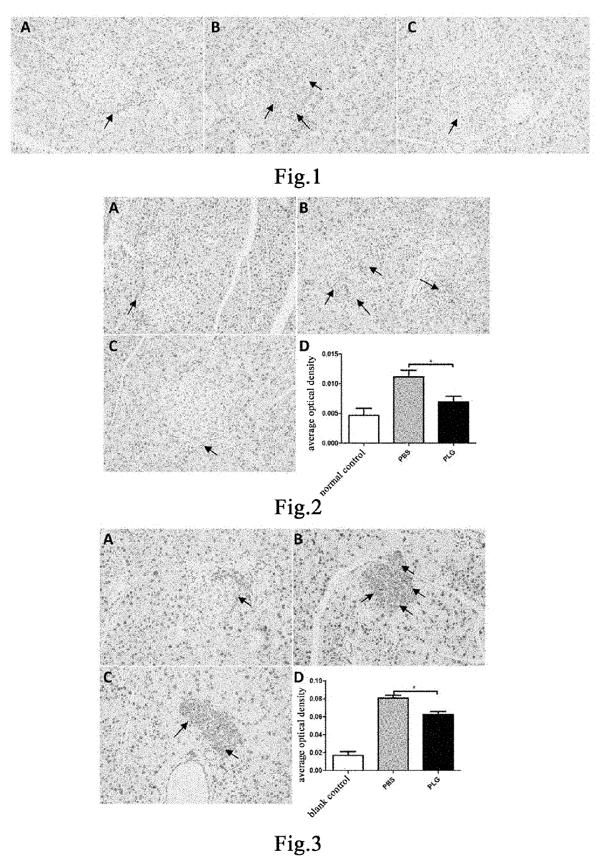 Method for making glucagon and insulin restore normal balance