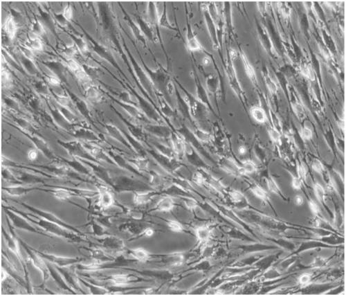 Suspension cultivation method of human cranial mesenchymal stem cell-derived neuron-like cells