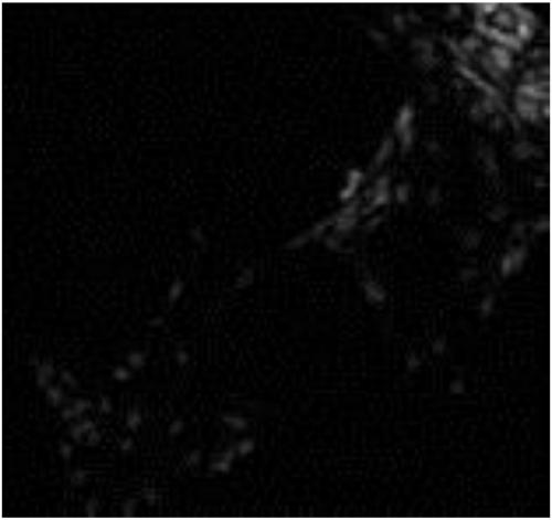 Suspension cultivation method of human cranial mesenchymal stem cell-derived neuron-like cells