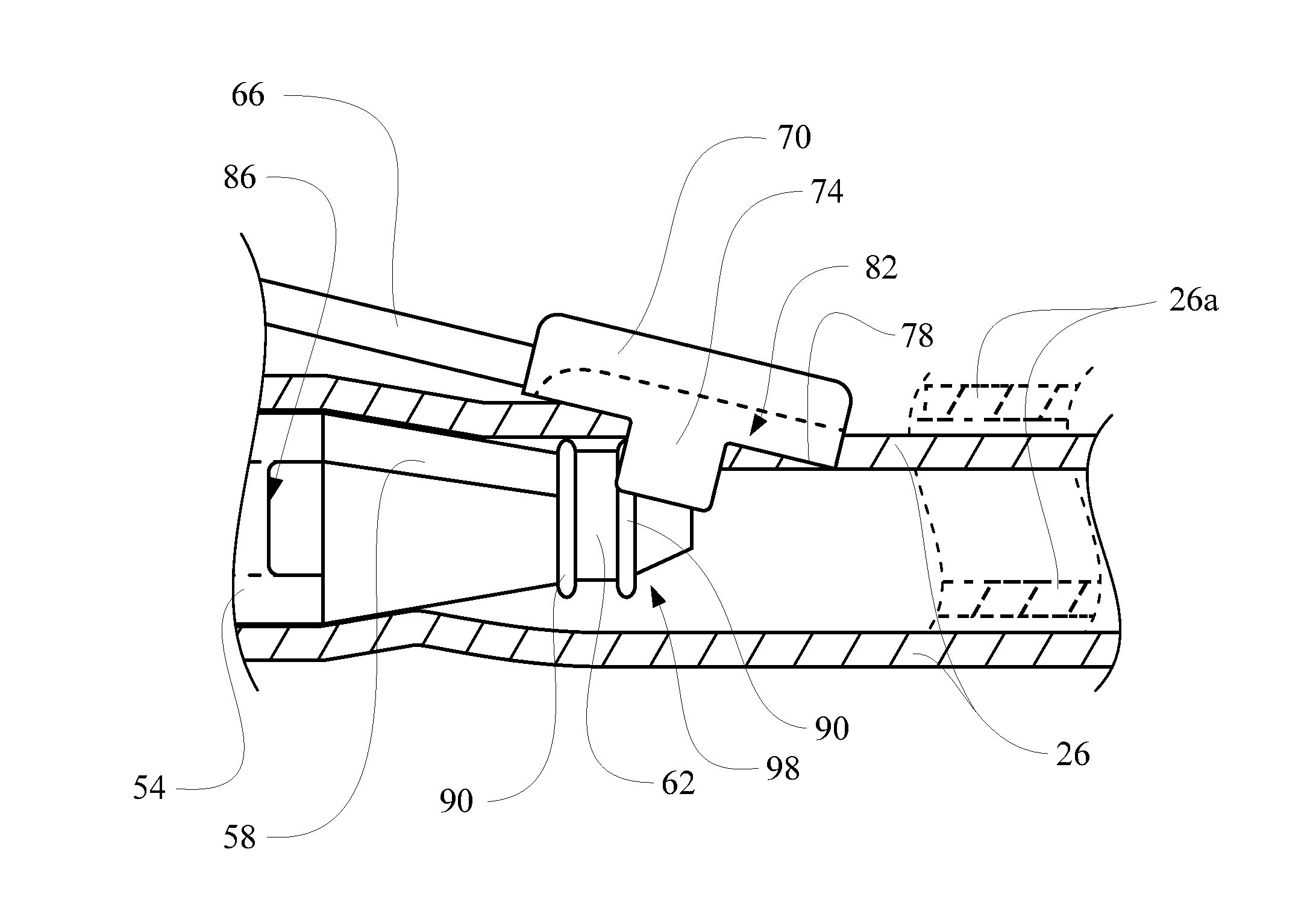 Anti free-flow occluder and priming actuator pad