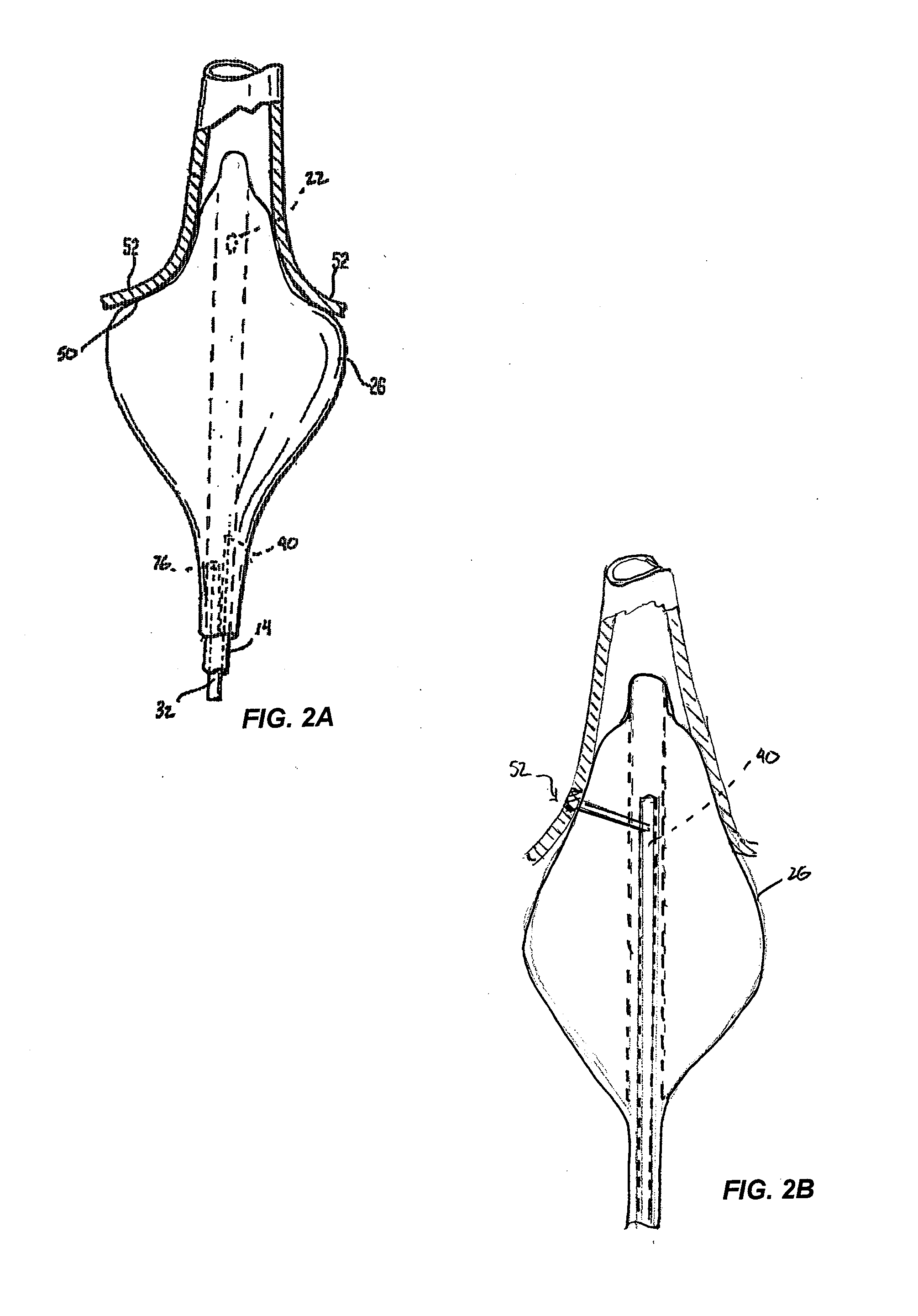 Cardiac ablation catheters for forming overlapping lesions