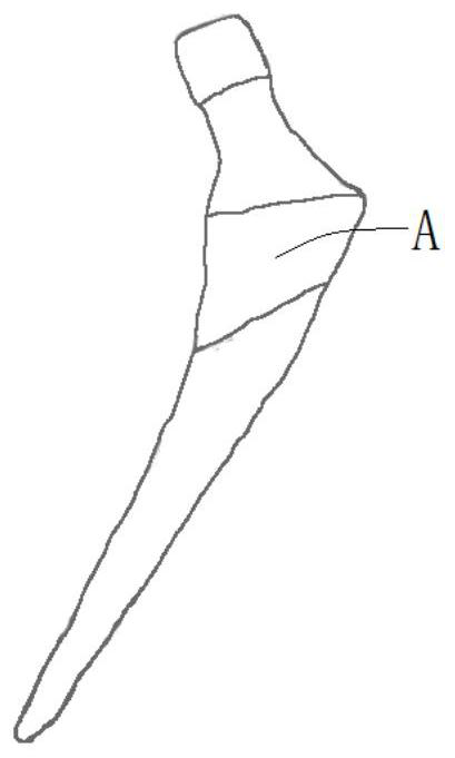 Artificial prosthesis and preparation method thereof