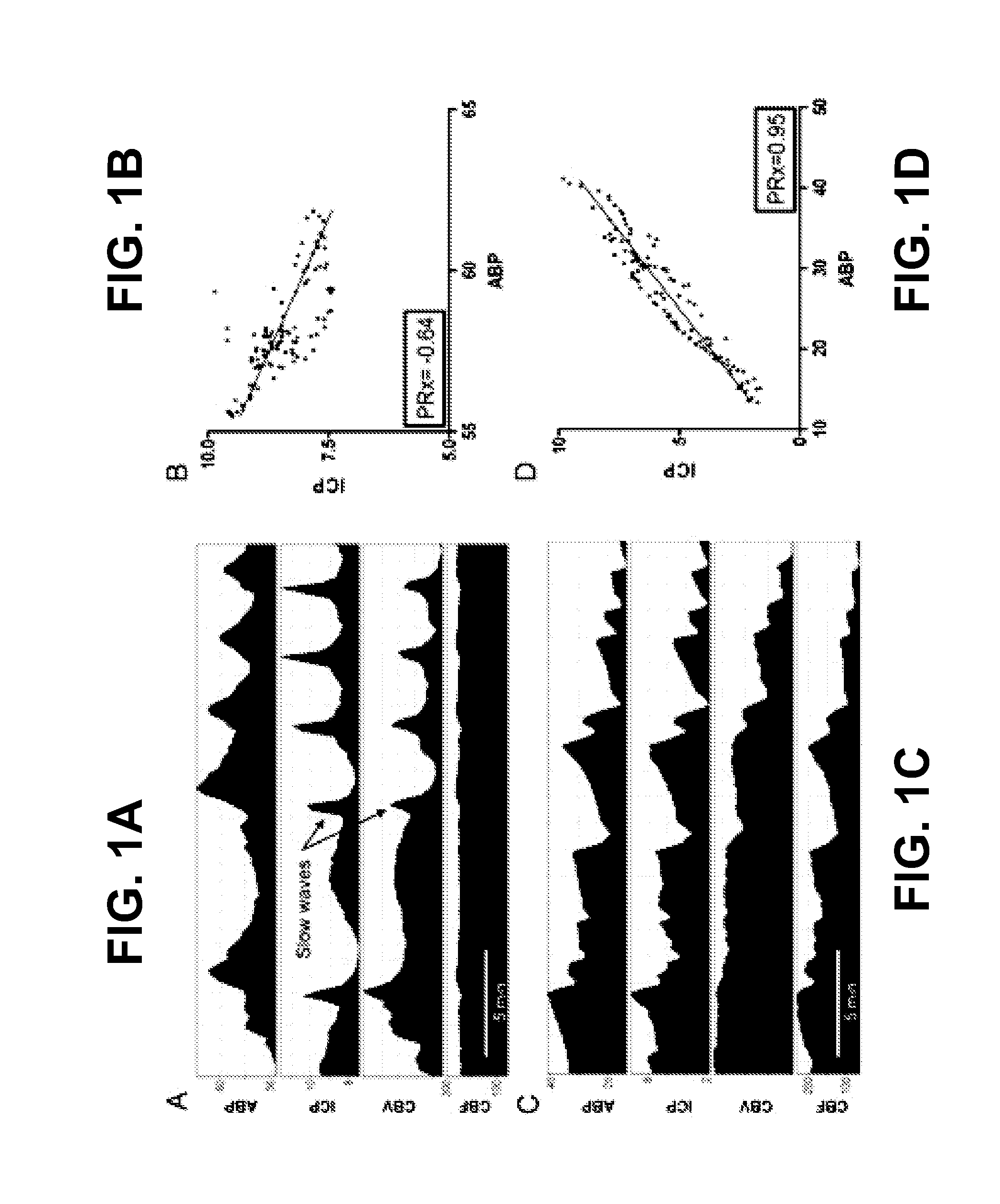 Autoregulation monitoring