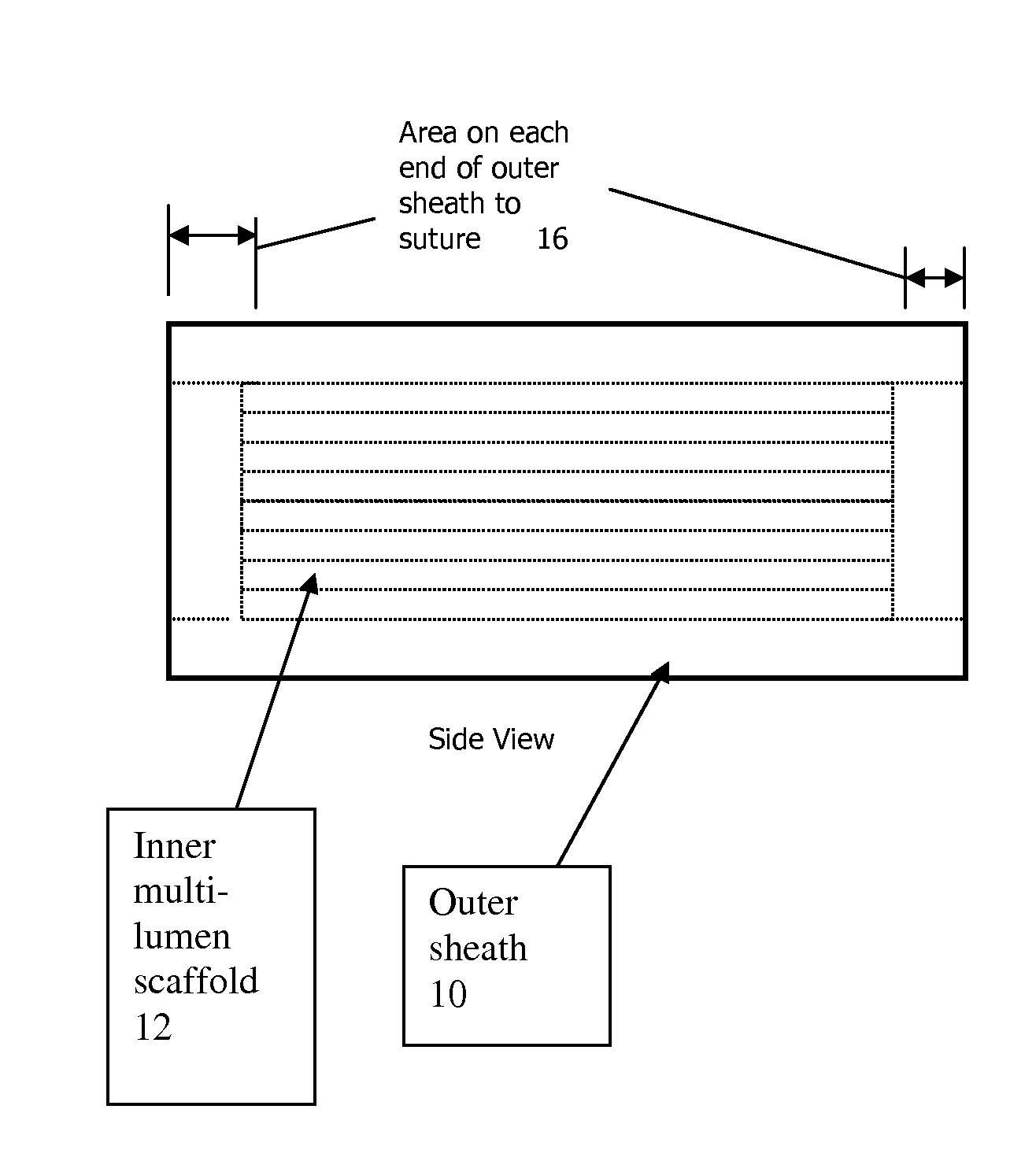 Nerve regeneration device