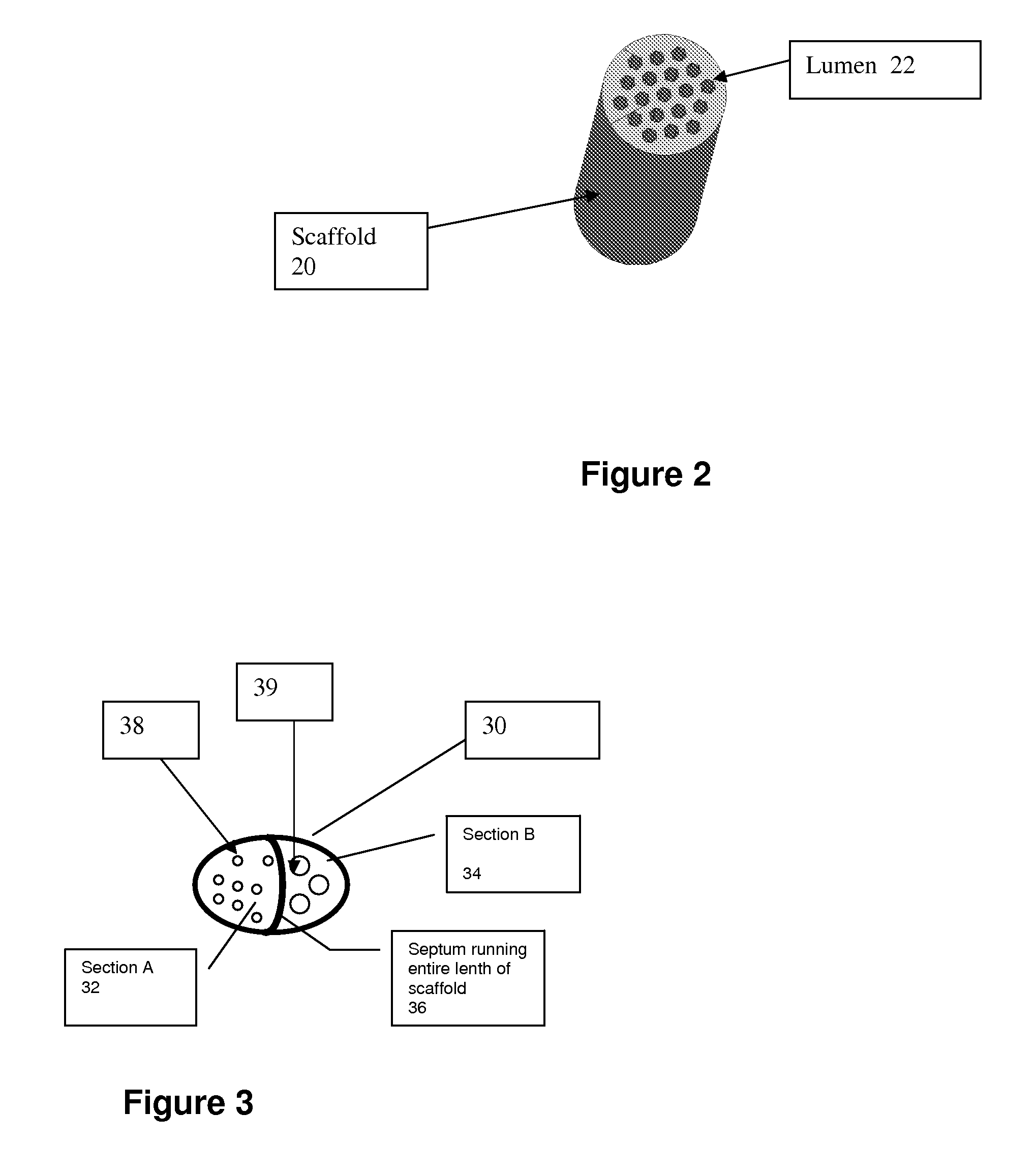 Nerve regeneration device