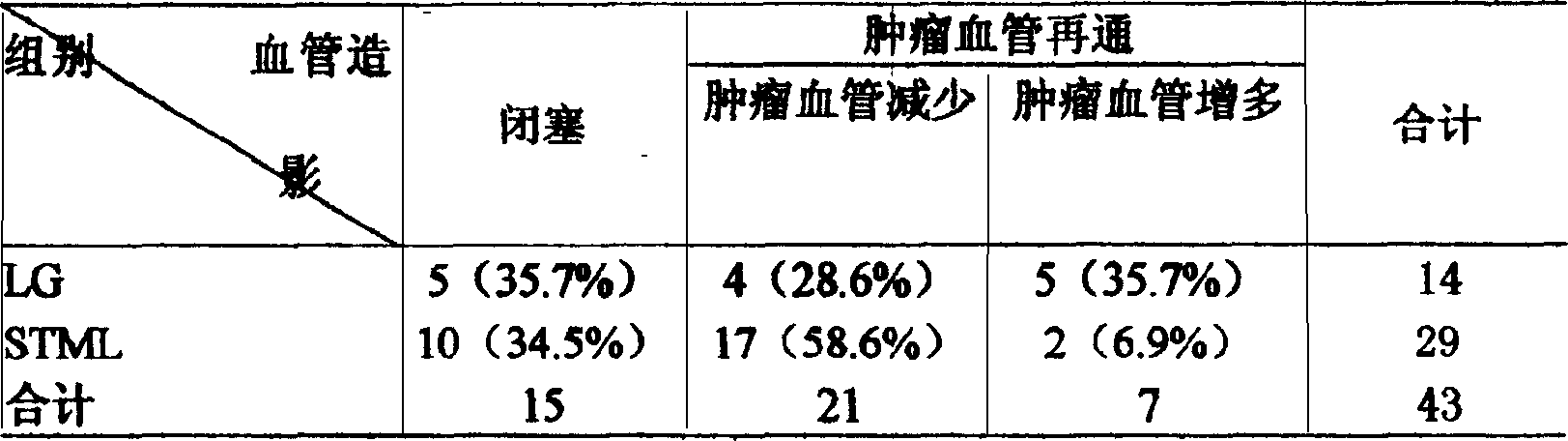 Suspension of Fe#-[3]O#-[4] microparticle and iodized oil for treating liver and kidney tumor by embolizing and its preparation process