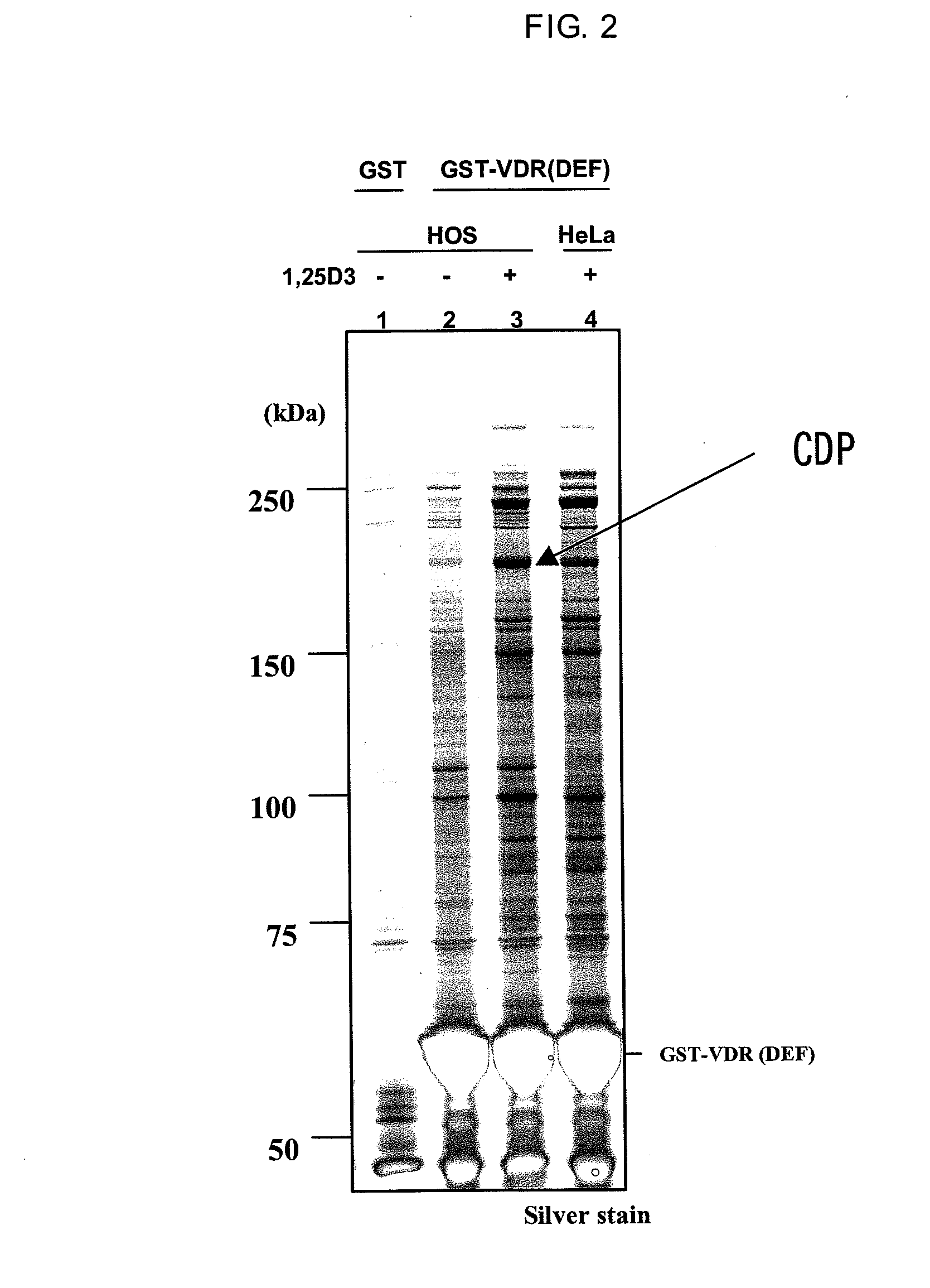 Method for screening for vitamin d receptor ligands