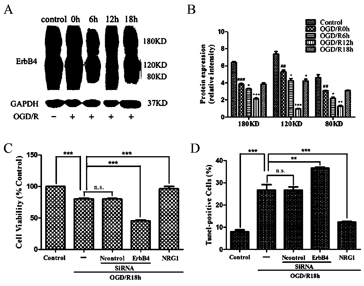 Application of membrane protein ErbB4 in preparation of medicines for treating cerebral ischemic injury