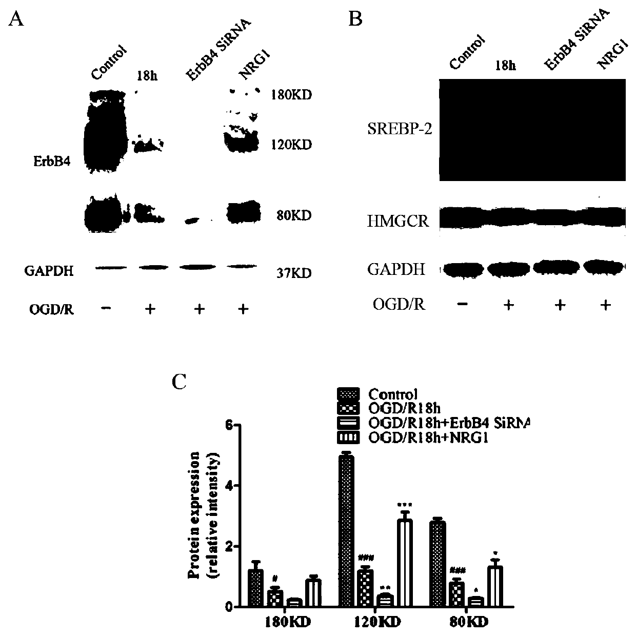 Application of membrane protein ErbB4 in preparation of medicines for treating cerebral ischemic injury