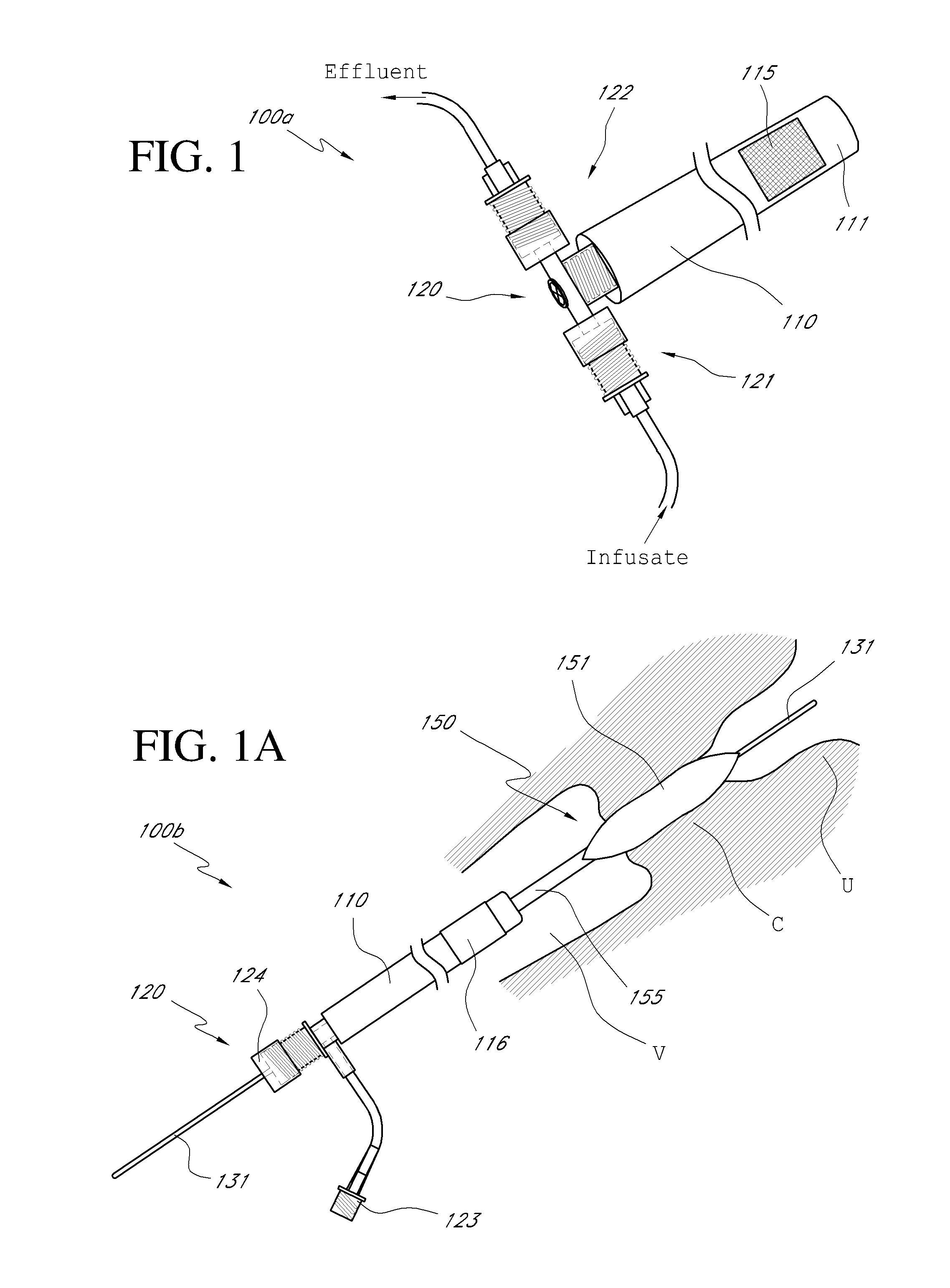 Systems, methods and devices for performing gynecological procedures