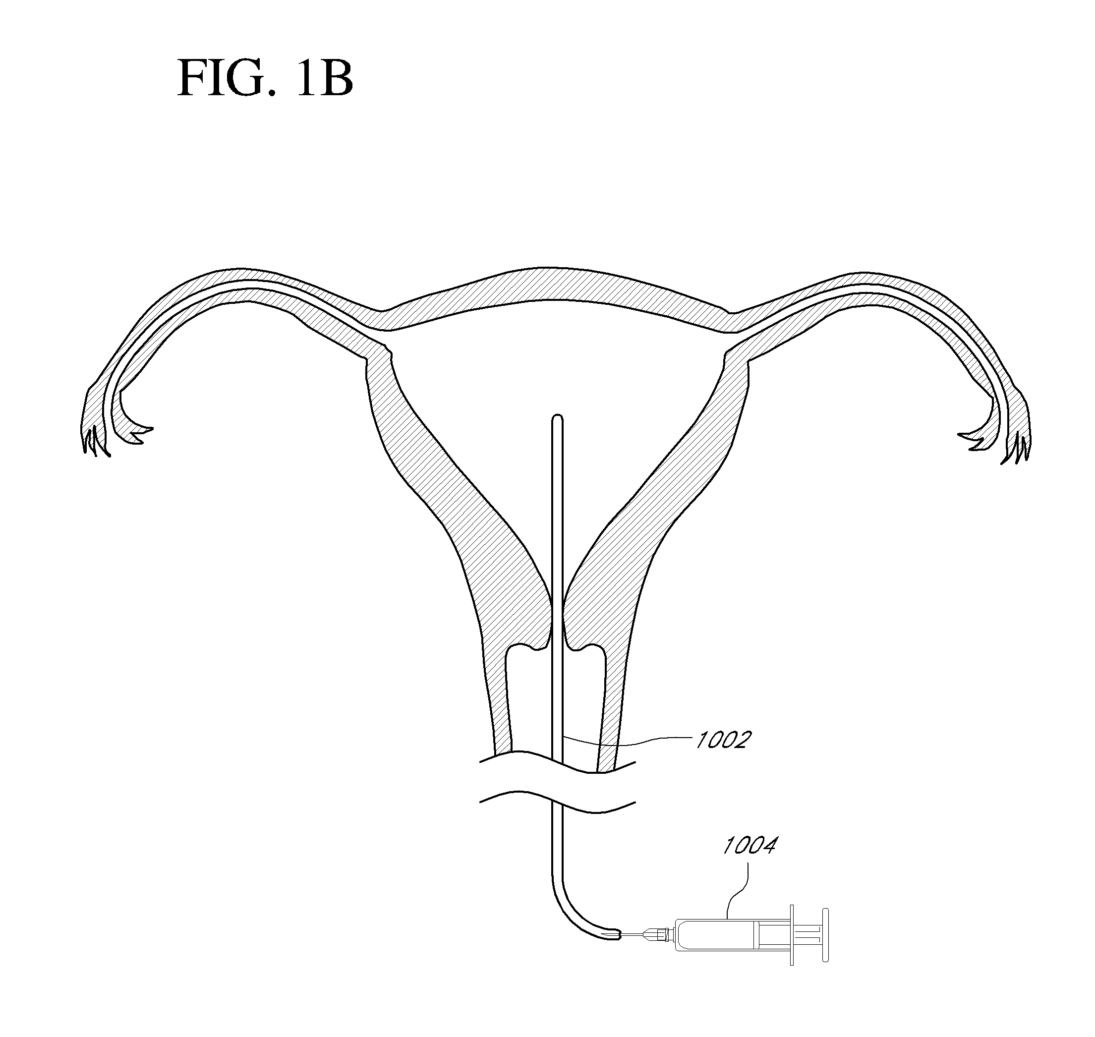 Systems, methods and devices for performing gynecological procedures