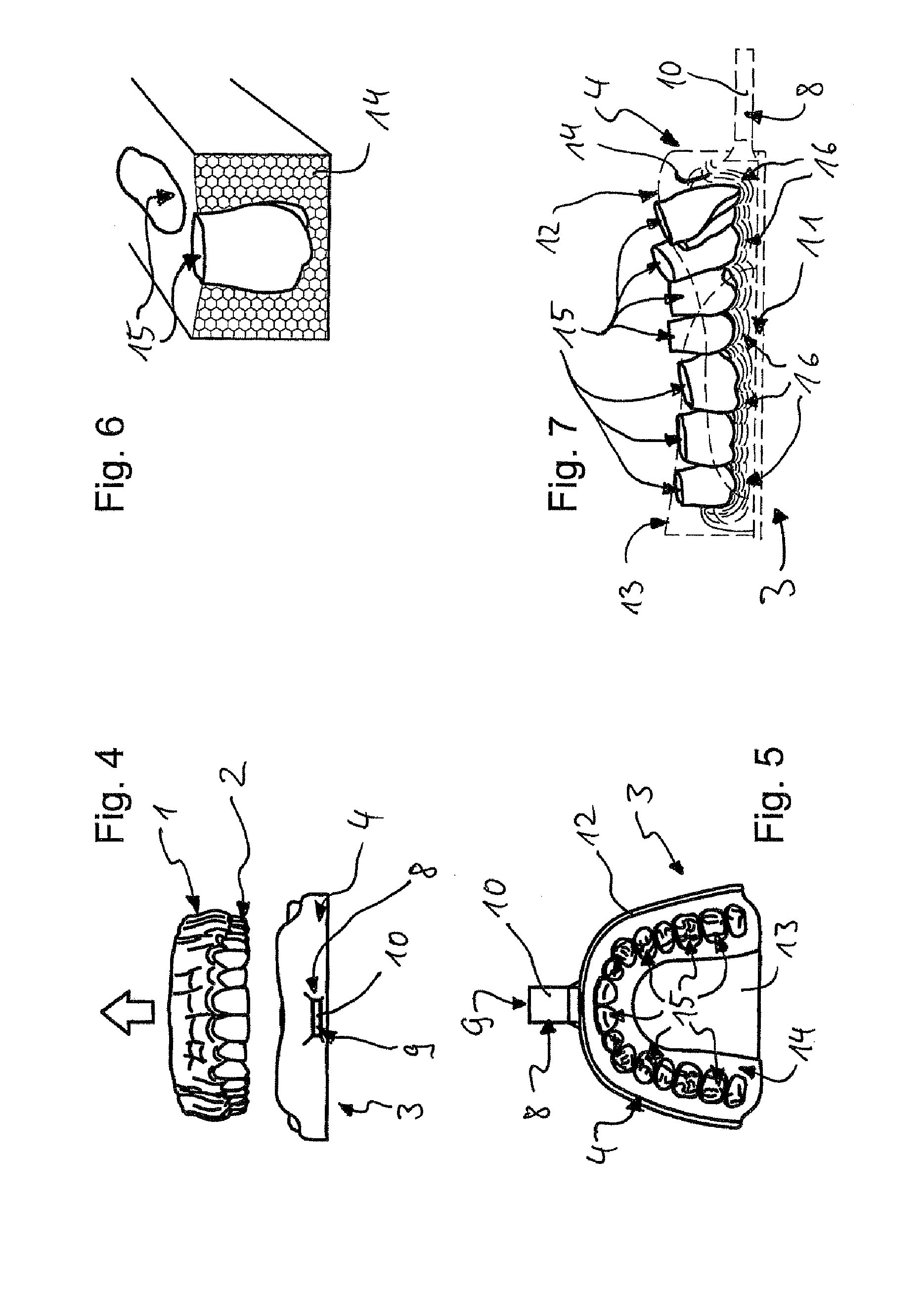 Impression tray, and method for capturing structures, arrangements or shapes, in particular in the mouth or human body