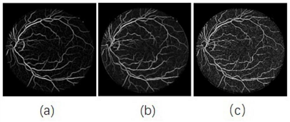 Retinal vessel segmentation method and device based on multi-scale matched filtering and particle swarm optimization