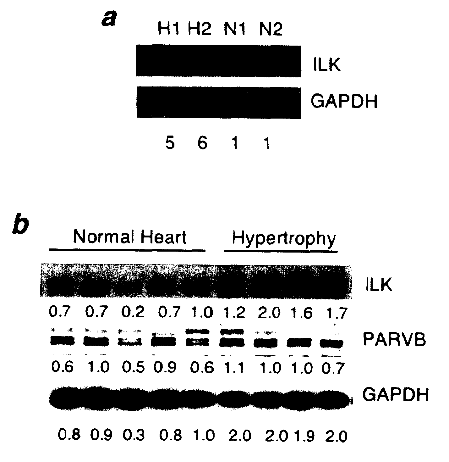 Modulation of the Integrin Linked Kinase Signaling Pathway to Promote Cardiac Cell Proliferation and Self-Renewal