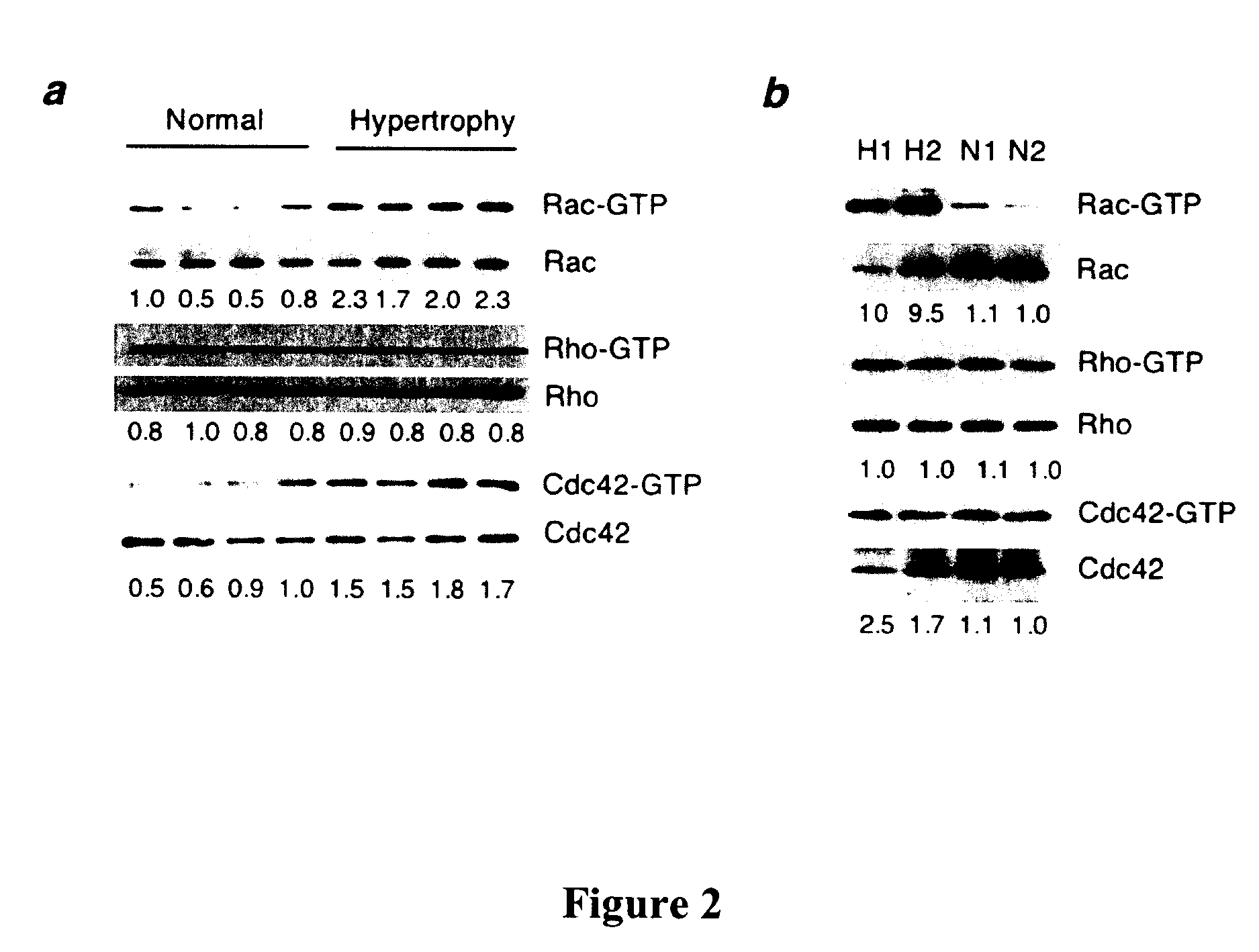 Modulation of the Integrin Linked Kinase Signaling Pathway to Promote Cardiac Cell Proliferation and Self-Renewal