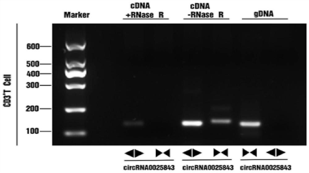 SLE-related circular RNA hsa_circ_0025843 and application thereof