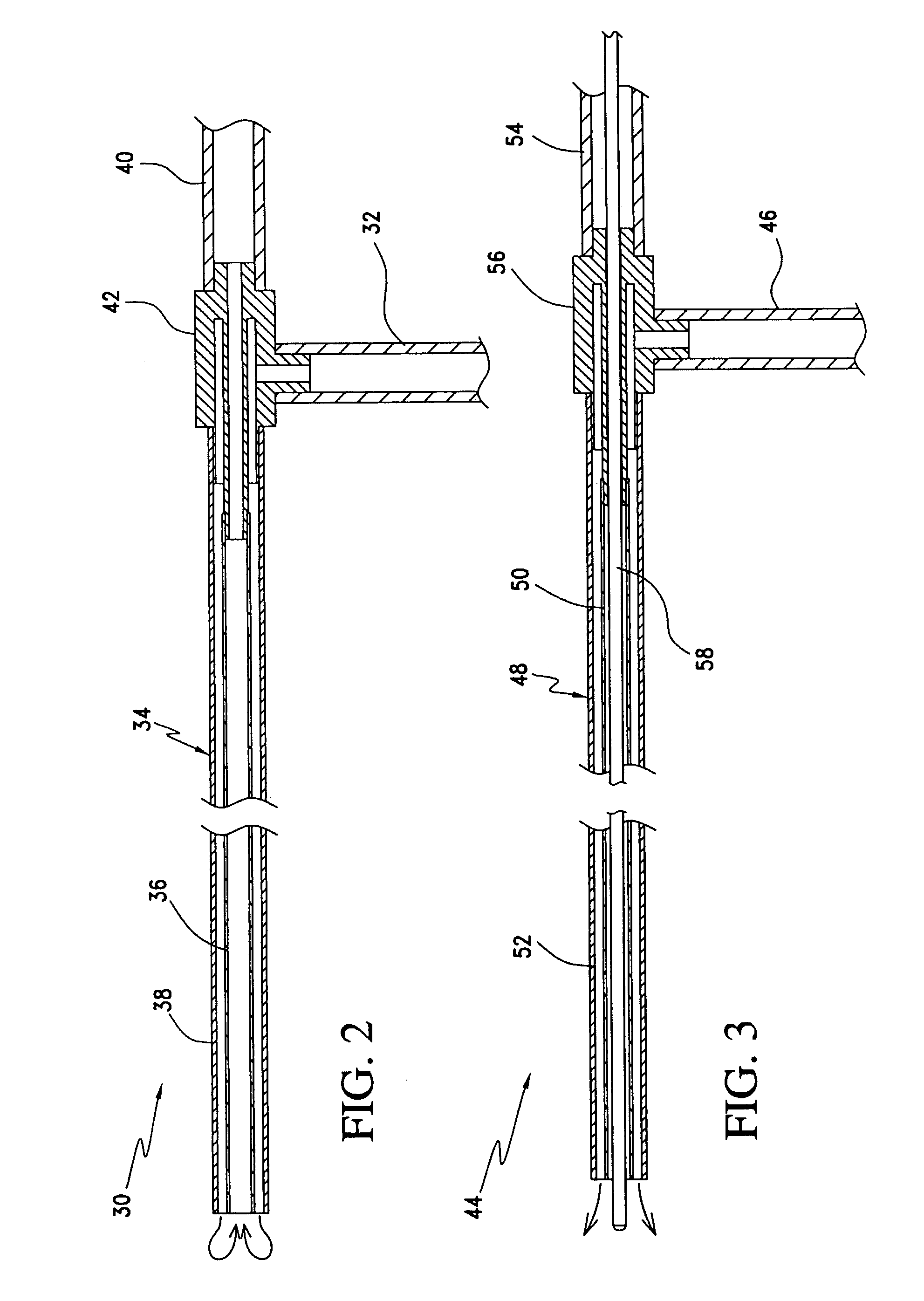 Open system heat exchange catheters and methods of use