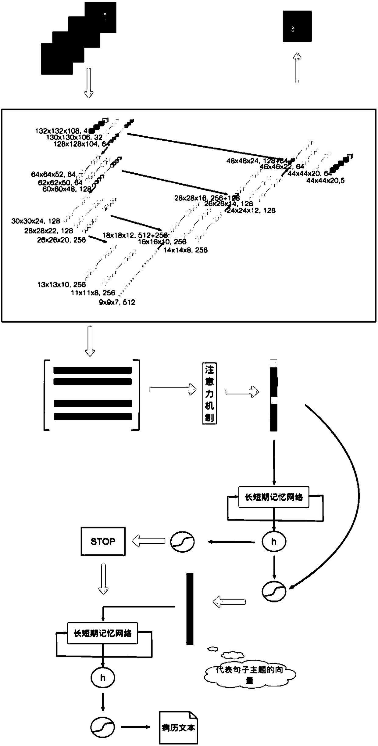 Multi-modal nuclear magnetic resonance image case report automatic generation method