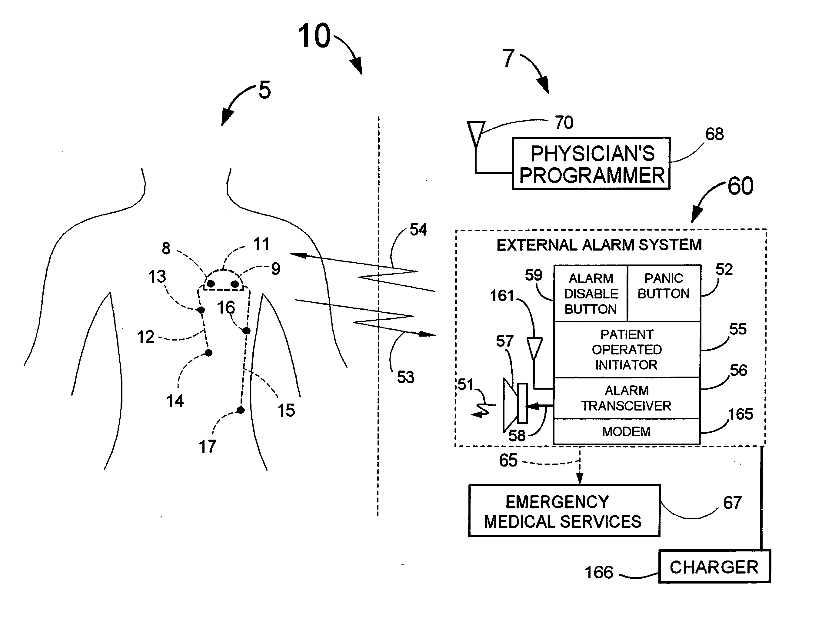 Means and method for the detection of cardiac events