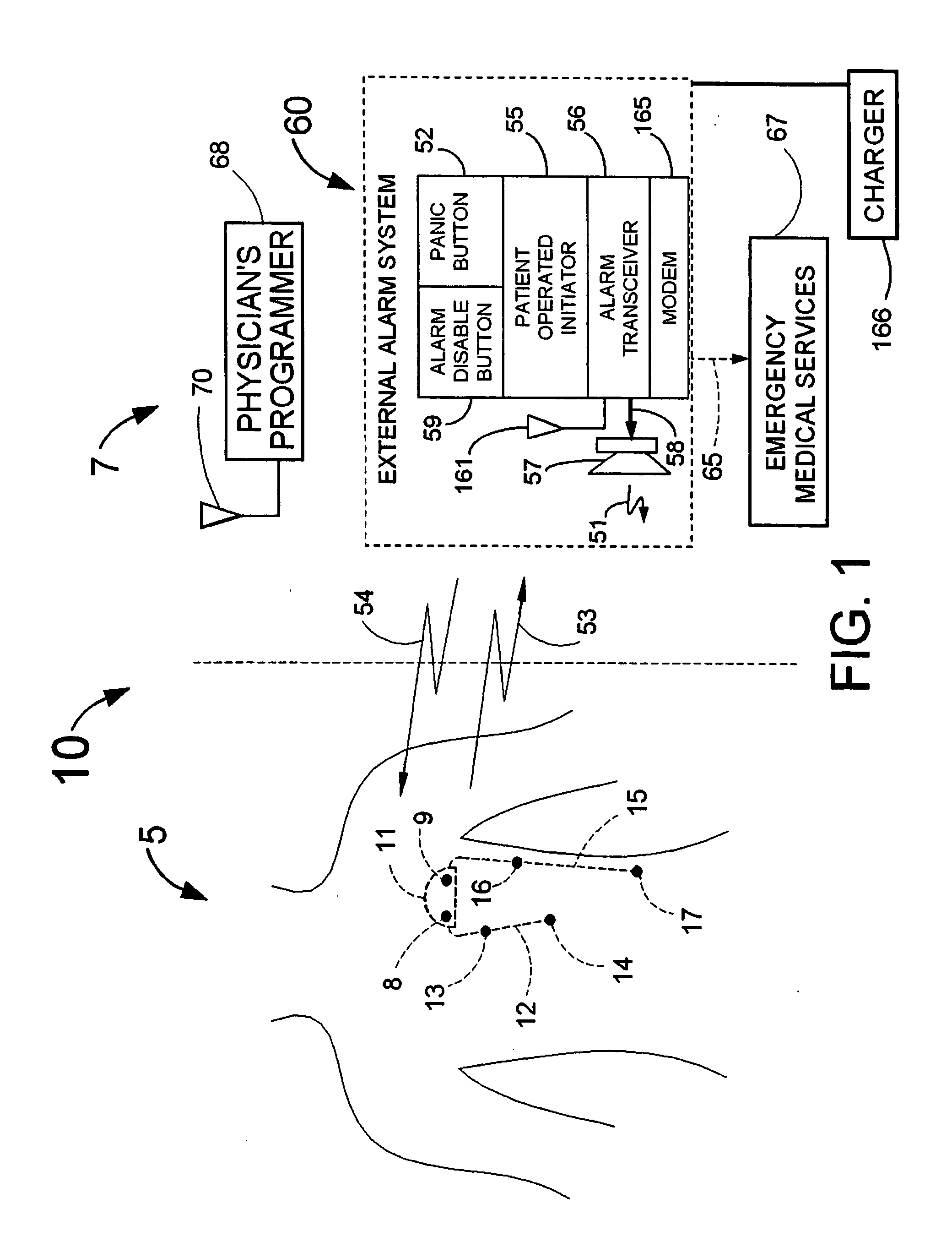 Means and method for the detection of cardiac events