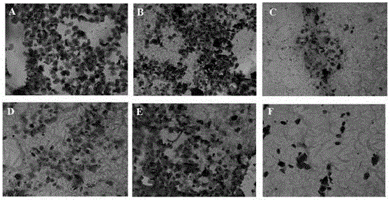 HPV16E7 monoclonal antibody and preparation method and application thereof