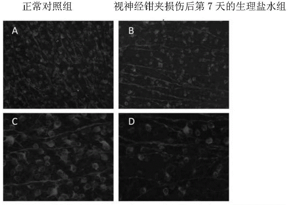 Application of minocycline in protection of retinal ganglion cells