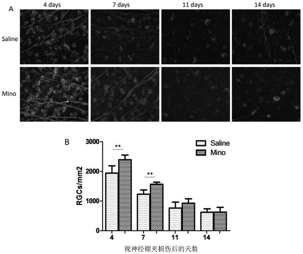 Application of minocycline in protection of retinal ganglion cells