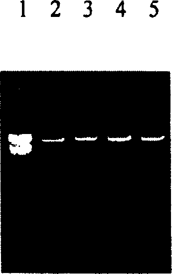 Human SP-A1 expression in pichia pastoris