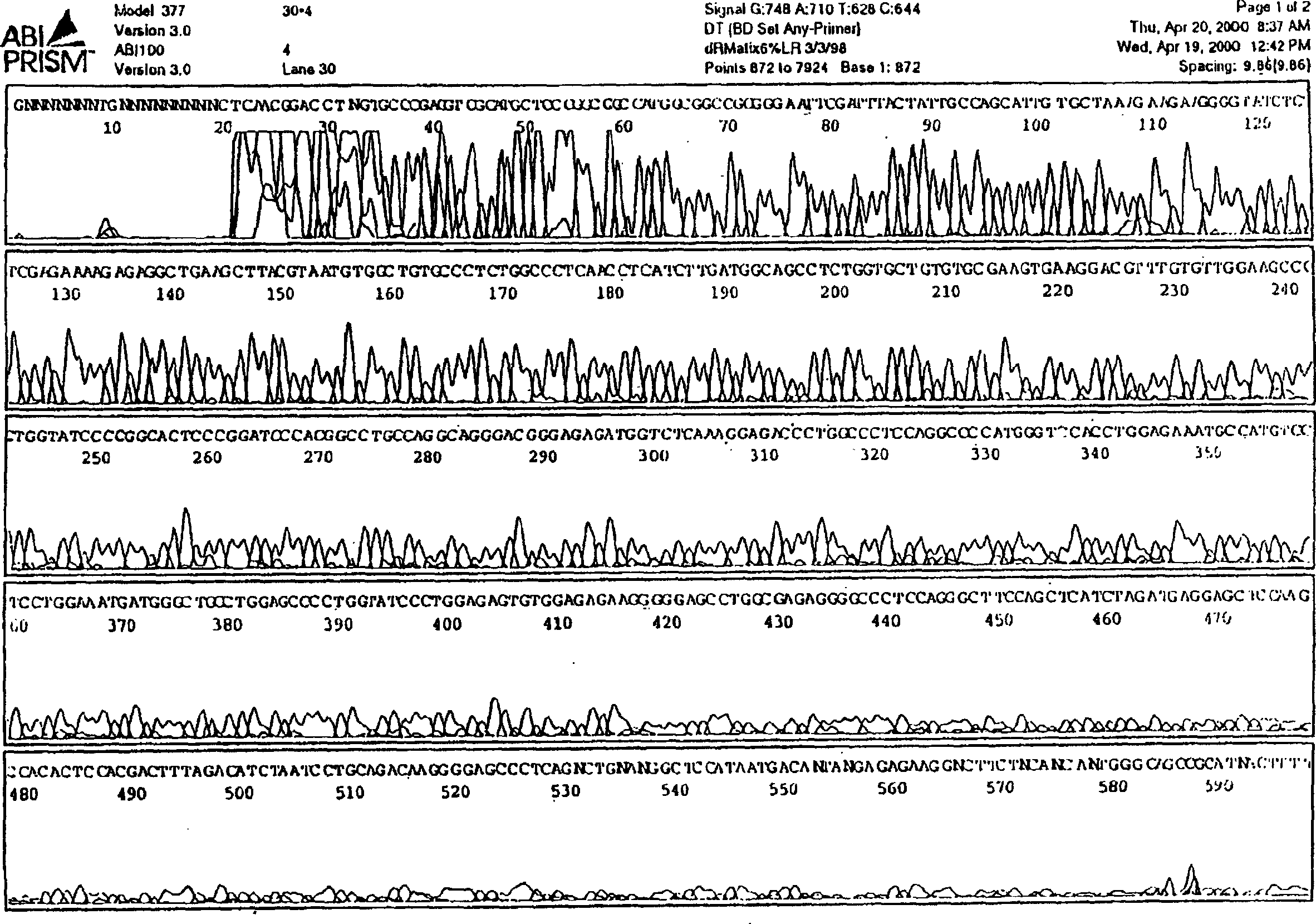 Human SP-A1 expression in pichia pastoris