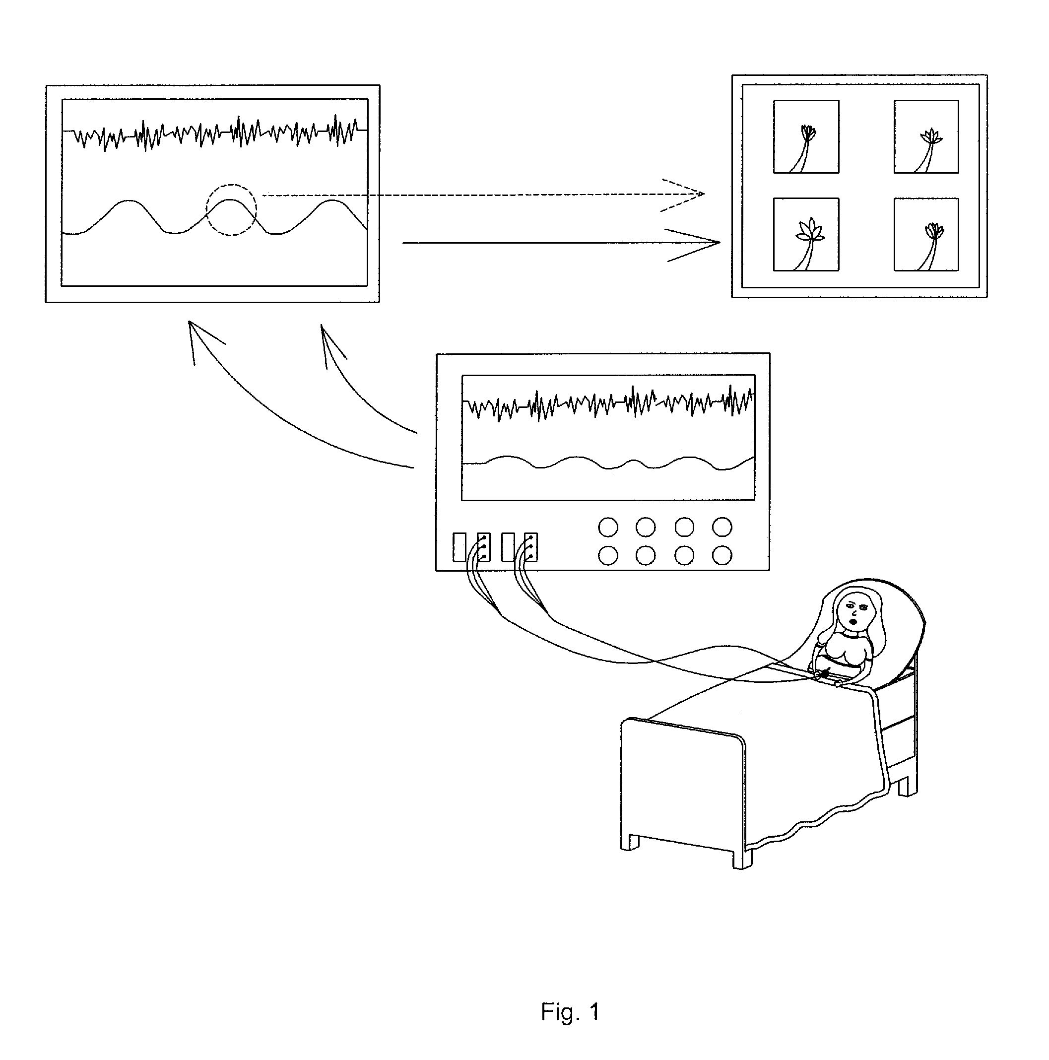 Method and apparatus providing timed visual images during childbirth