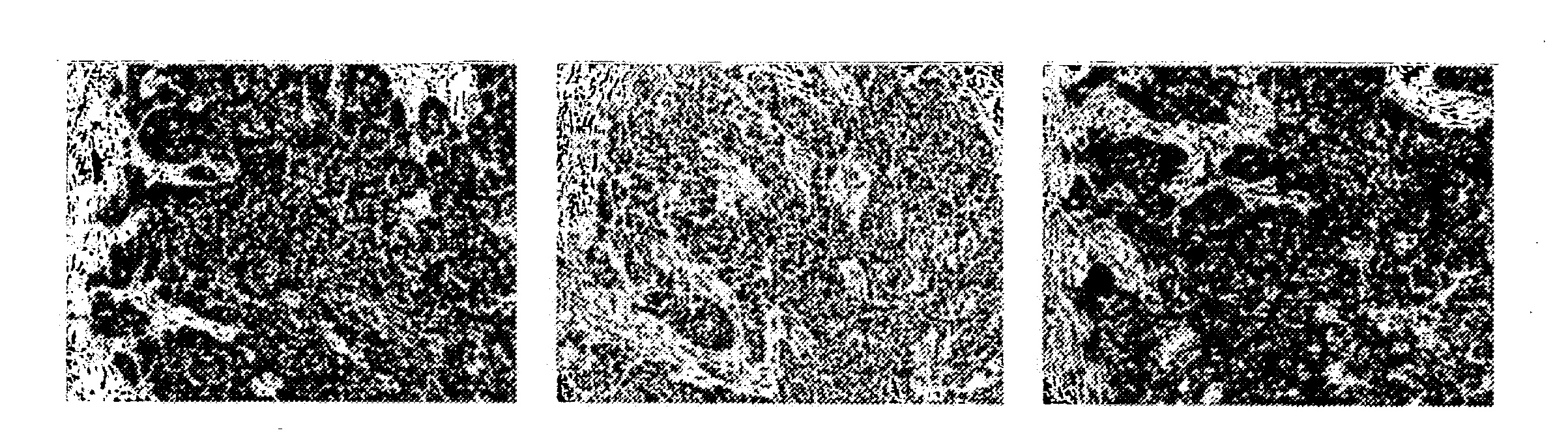 Neoplasm specific antibodies and uses thereof