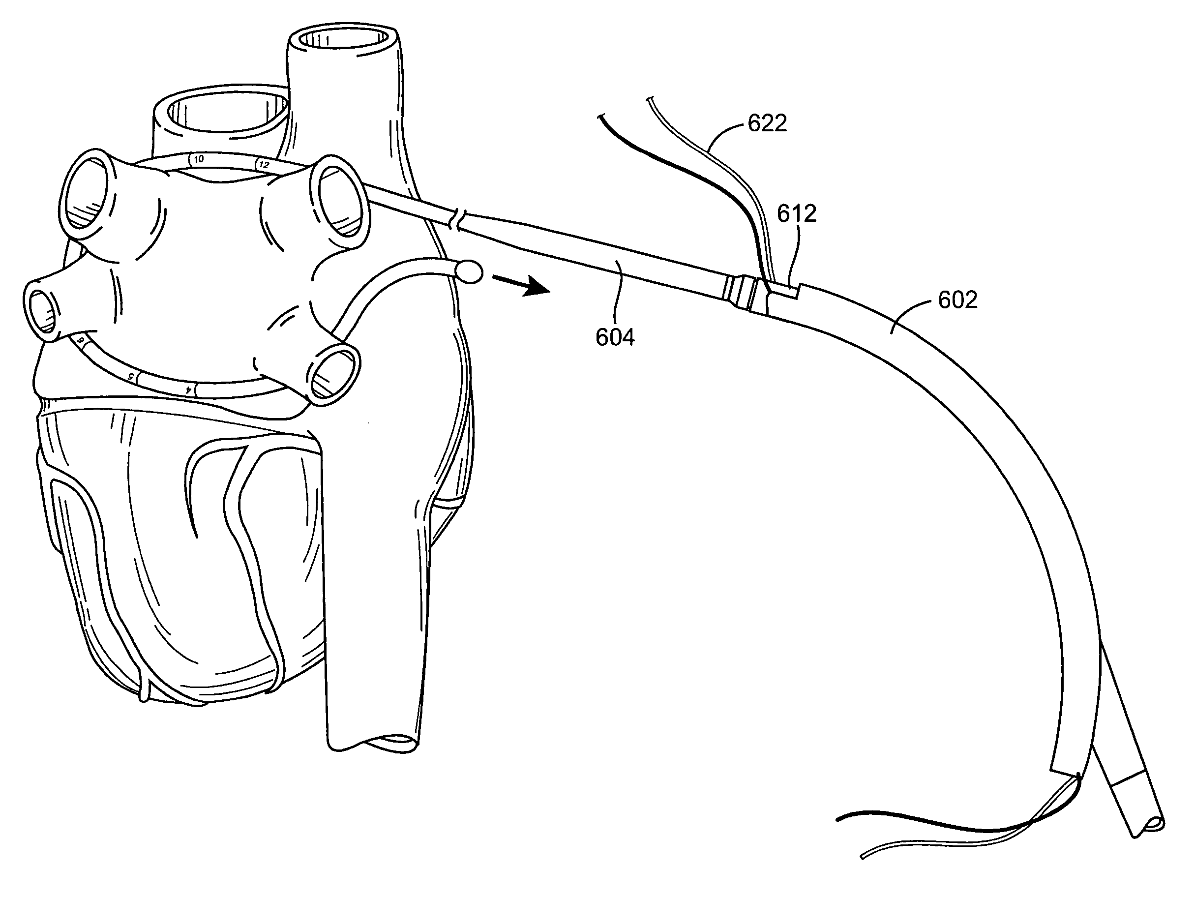 Methods and devices for ablation