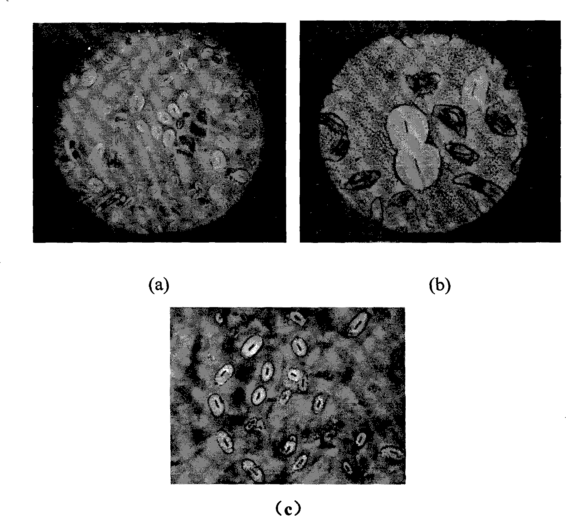 Capsule staining of bacteria