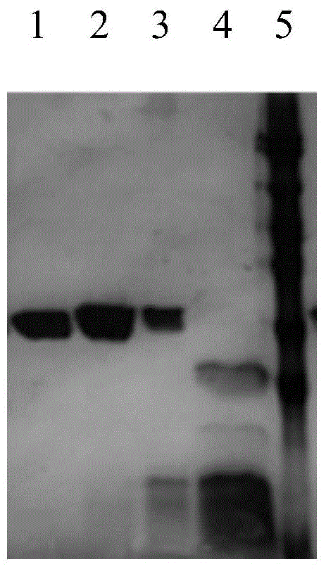 B-group epidemic neisseria meningitidis recombinant protein vaccine and preparing method thereof