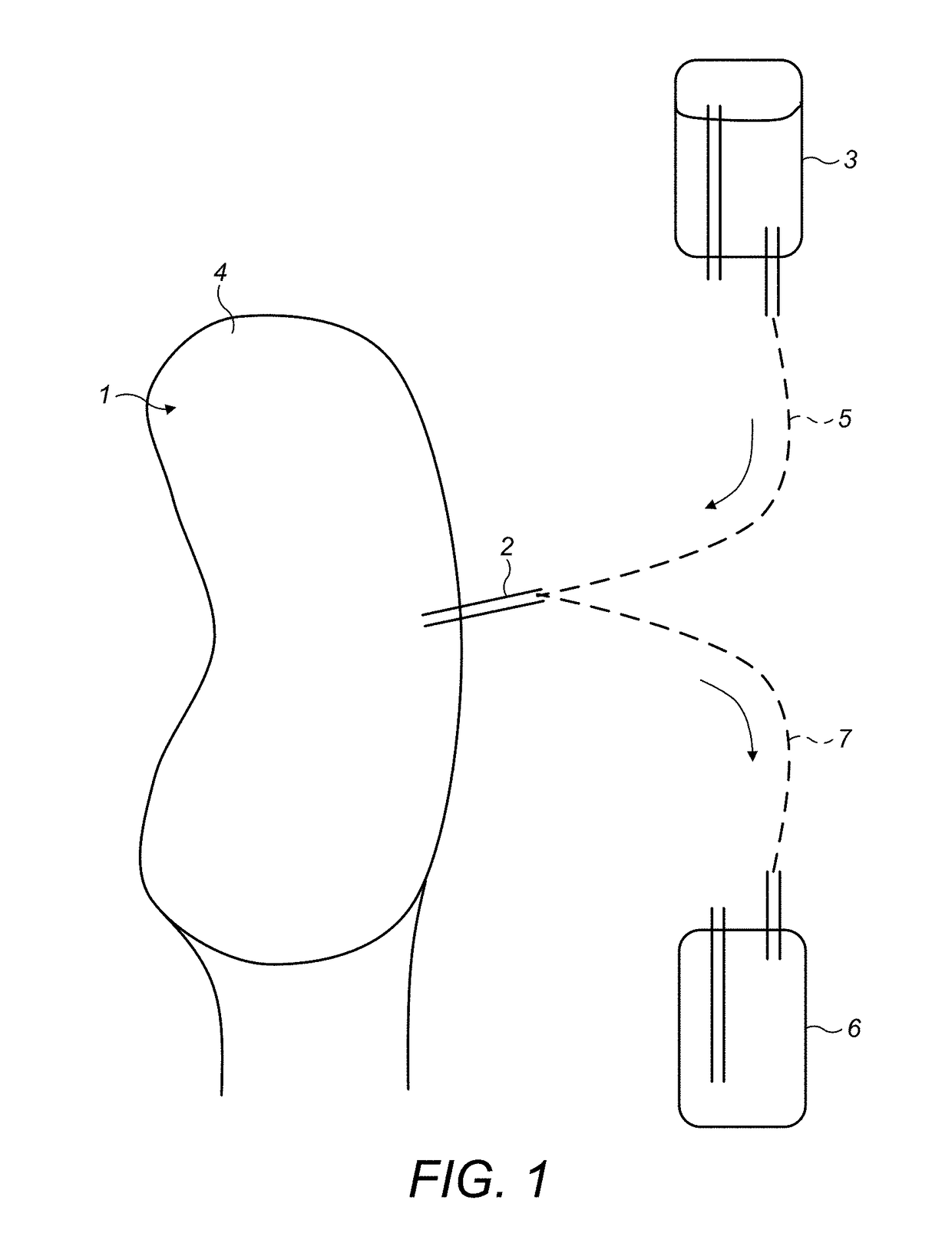 Diagnostic Test with Lateral Flow Test Strip