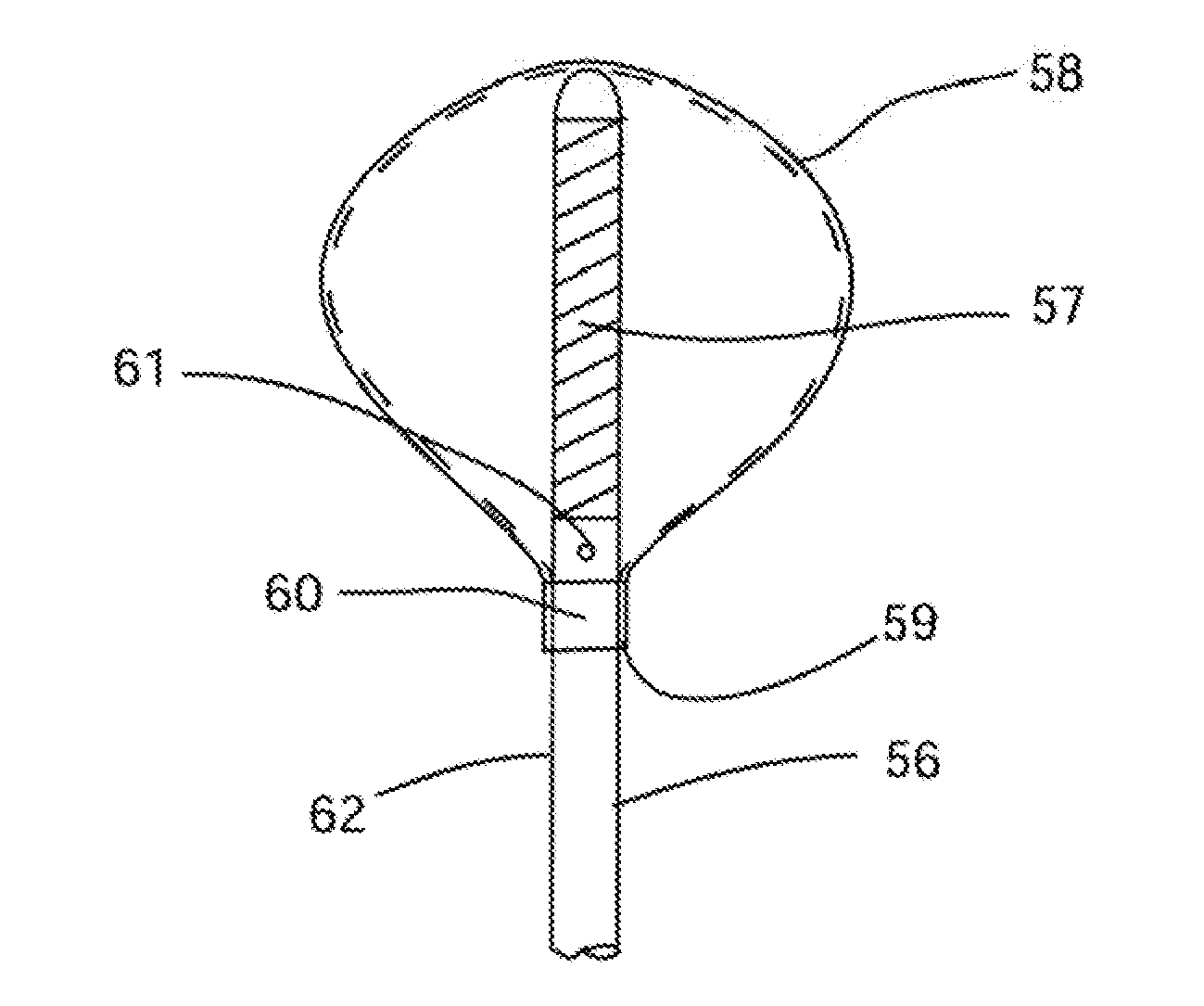 Apparatus and Methods for Treating Rhinitis