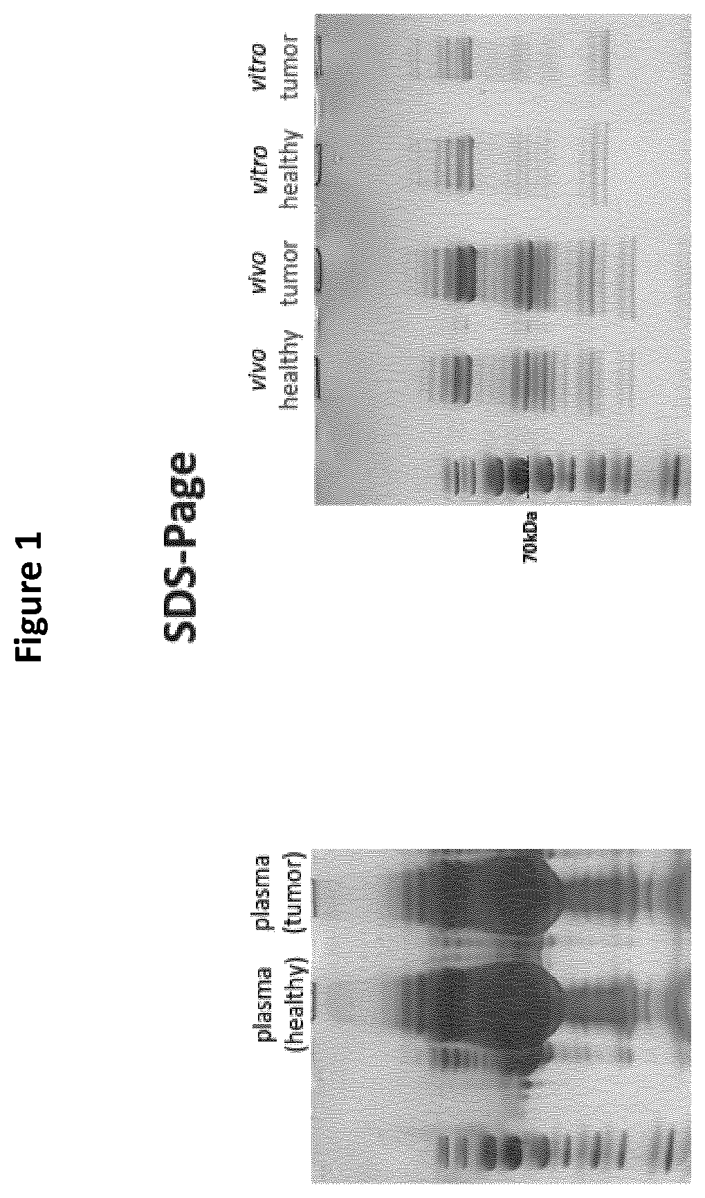 Detection of cancer biomarkers using nanoparticles