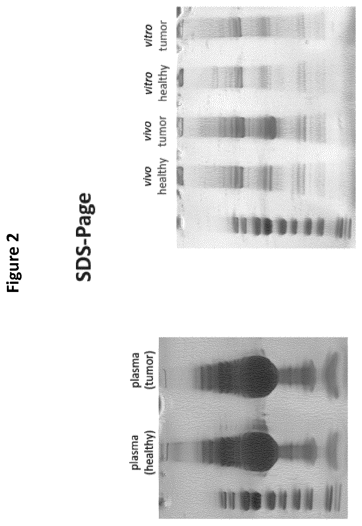 Detection of cancer biomarkers using nanoparticles