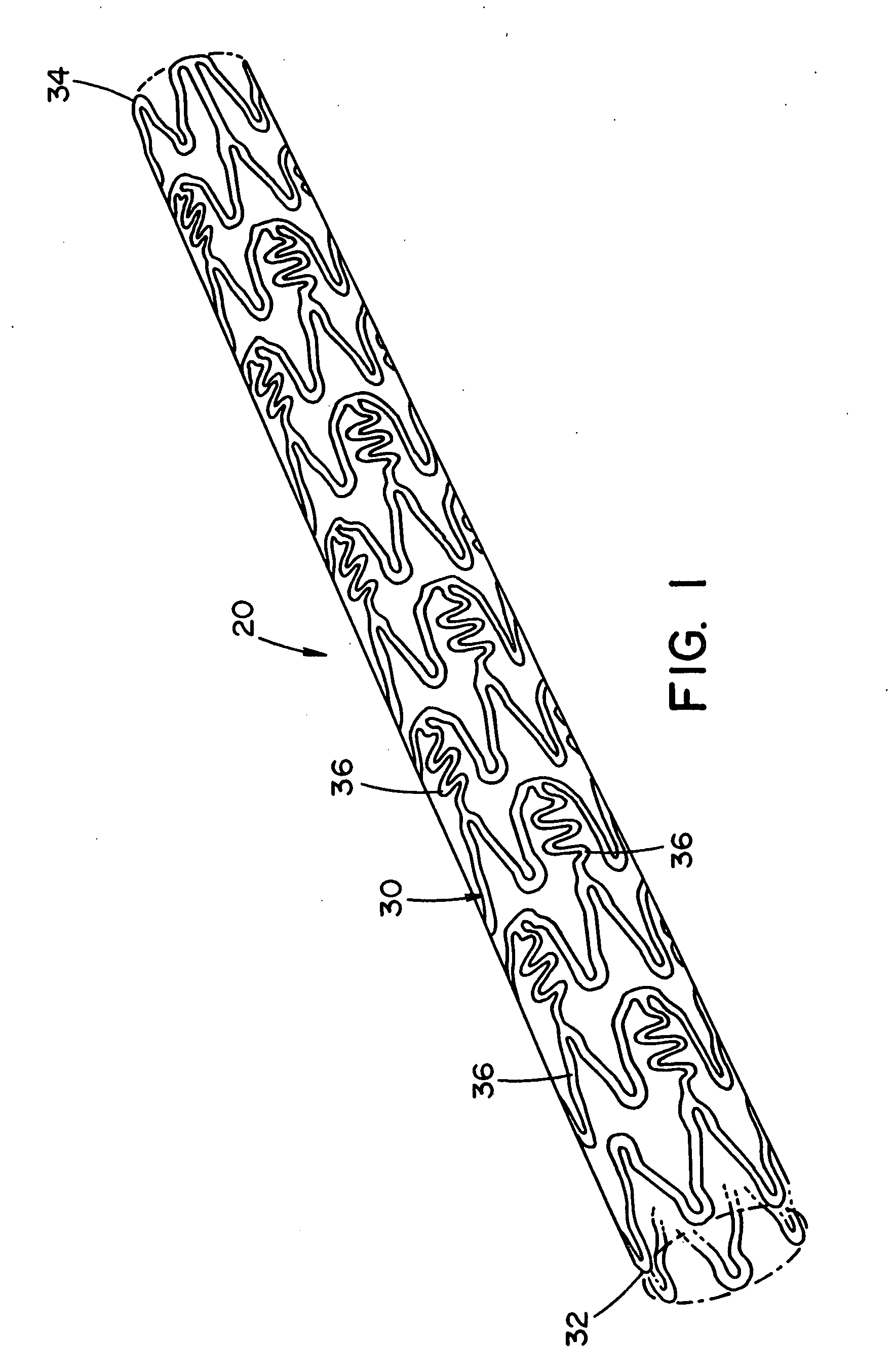 Process for forming an improved metal alloy stent