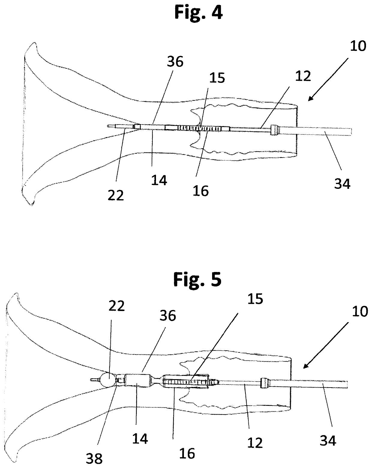 Cervical canal dilation device