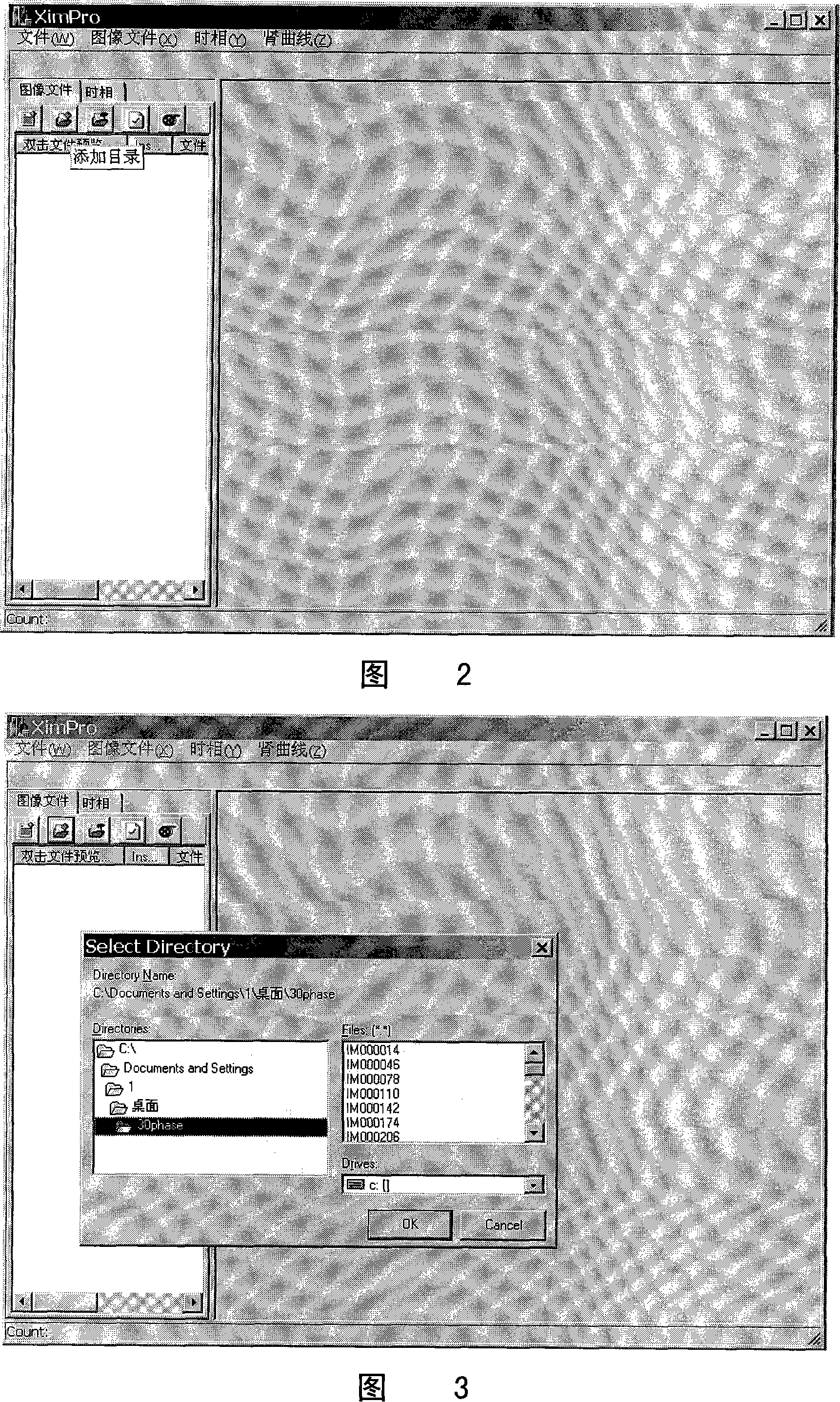 Image processing process based on magnetic resonance three-dimensional renogram