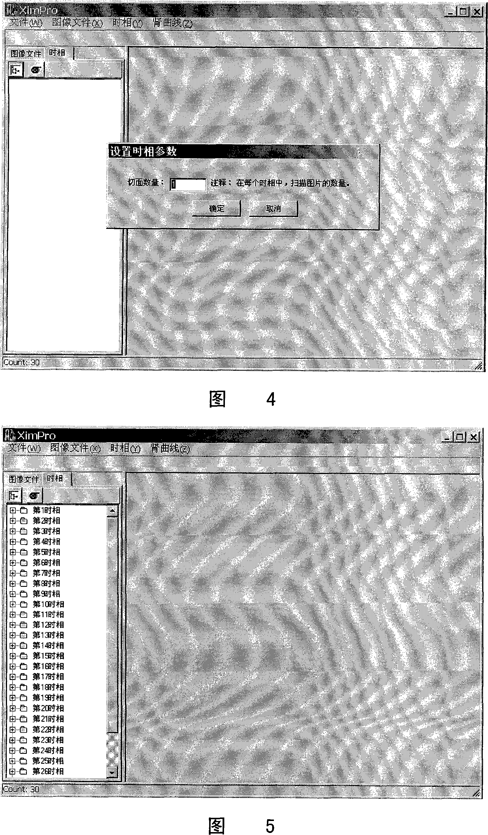 Image processing process based on magnetic resonance three-dimensional renogram