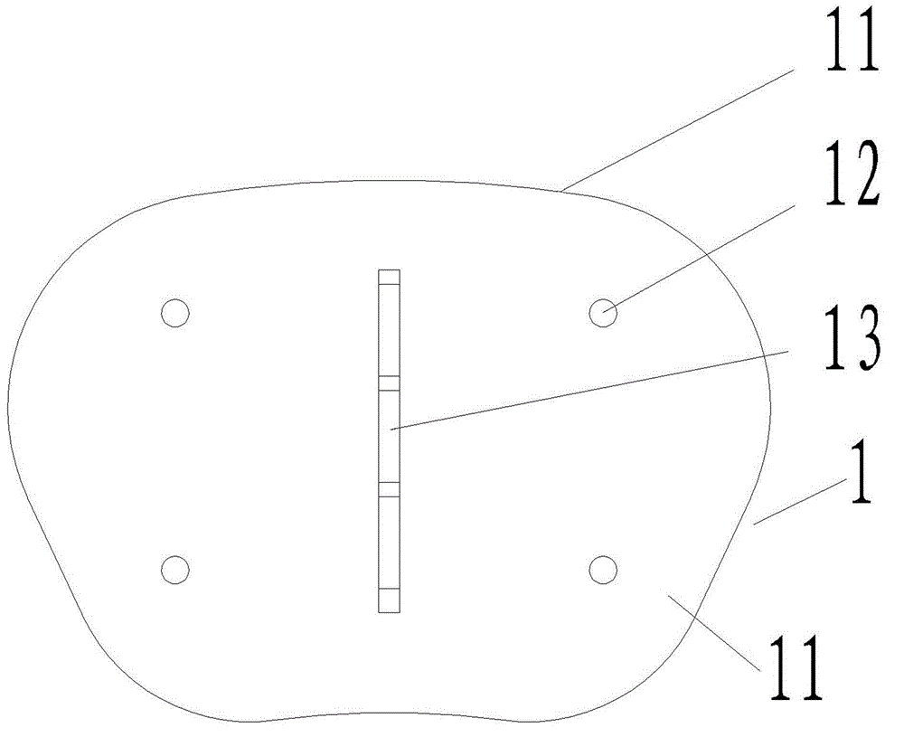 Combined artificial vertebral body