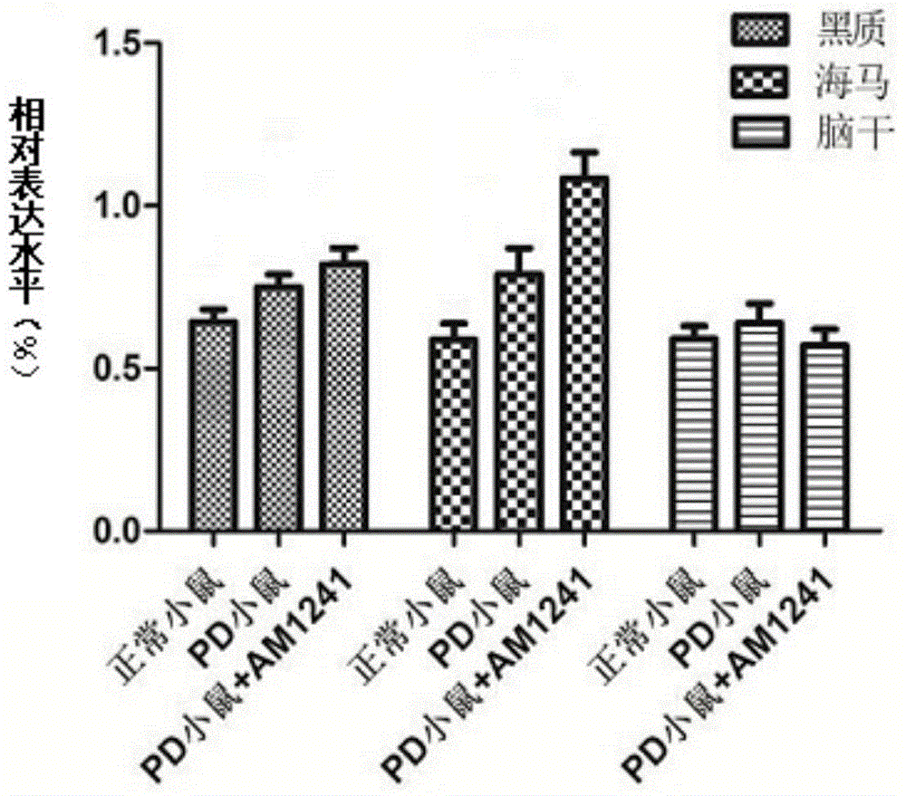 Application of compound to preparation of drug for treating Parkinson's disease