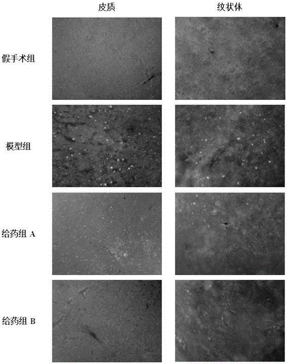 Application of snake-gourd-fruit and cinnamon-twig decoction to preparing of medicine for treating cerebral arterial thrombosis sequelae