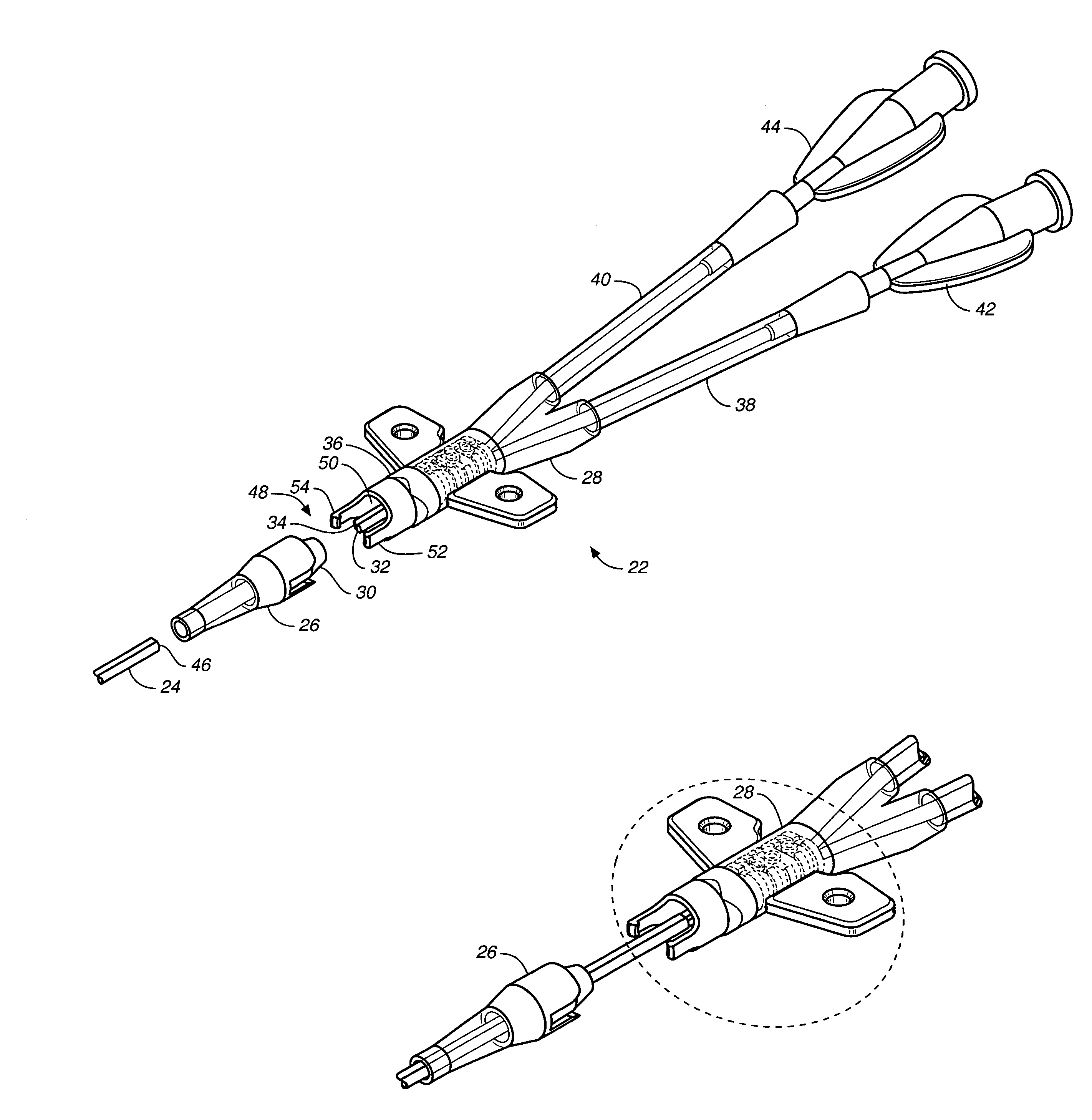 Catheter connector system